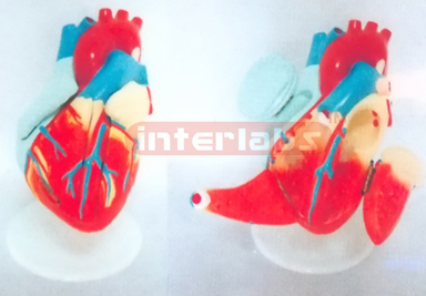 MIDDLE ADVANCED HEART MODEL